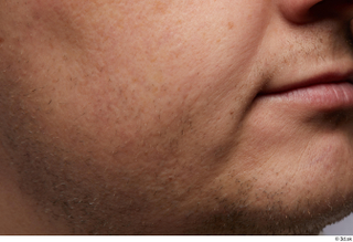 HD Face Skin Agustin Wilkerson cheek face skin pores skin…